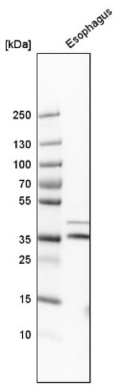 GPR157 Antibody, Novus Biologicals 0.1 mL | Buy Online | Novus Biologicals | Fisher Scientific